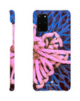 Knot Phone Case Galaxy S20 Plus 2