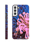 Knot Phone Case Galaxy S22 Plus 10