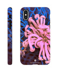 Knot Phone Case iPhone X 19