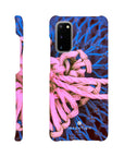 Knot Phone Case Galaxy S20 8