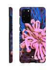 Knot Phone Case Galaxy S20 Plus 8