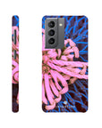 Knot Phone Case Galaxy S21 12