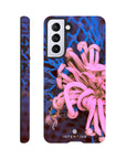 Knot Phone Case Galaxy S21 4
