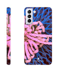Knot Phone Case Galaxy S21 Plus 4